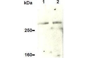 Western Blotting (WB) image for anti-Ataxia Telangiectasia and Rad3 Related (ATR) antibody (ABIN1449281)