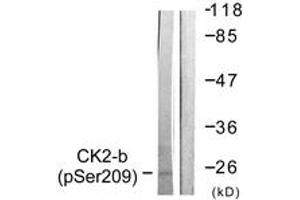Western blot analysis of extracts from HuvEc cells, using CKII-beta (Phospho-Ser209) Antibody. (CSNK2B Antikörper  (pSer209))