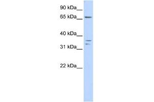 WB Suggested Anti-IQCE Antibody Titration: 0.