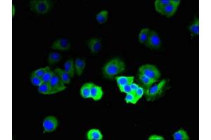 Immunofluorescent analysis of MCF-7 cells using ABIN7171285 at dilution of 1:100 and Alexa Fluor 488-congugated AffiniPure Goat Anti-Rabbit IgG(H+L) (TRBC1 Antikörper  (AA 1-176))