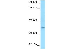 WB Suggested Anti-C9orf30 Antibody Titration: 1. (MSANTD3 Antikörper  (C-Term))