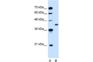 WB Suggested Anti-GOT2 Antibody Titration:  1. (GOT2 Antikörper  (N-Term))