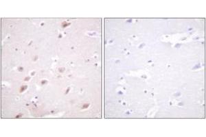 Immunohistochemistry analysis of paraffin-embedded human brain, using CKII-beta (Phospho-Ser209) Antibody. (CSNK2B Antikörper  (pSer209))