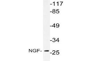 Western blot analysis of NGF Antibody in extracts from Jurkat cells. (Nerve Growth Factor Antikörper)