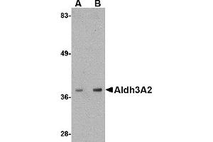 Western Blotting (WB) image for anti-Aldehyde Dehydrogenase 3 Family, Member A2 (ALDH3A2) (C-Term) antibody (ABIN1030231) (ALDH3A2 Antikörper  (C-Term))