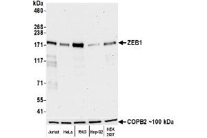 Western Blotting (WB) image for anti-Zinc Finger E-Box Binding Homeobox 1 (ZEB1) (AA 750-800) antibody (ABIN7455173) (Rekombinanter ZEB1 Antikörper  (AA 750-800))