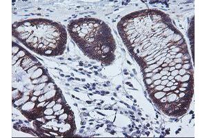 Immunohistochemical staining of paraffin-embedded Human colon tissue using anti-CAST mouse monoclonal antibody. (Calpastatin Antikörper)