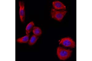 ABIN6263291 and ABIN6266590 staining Hela by IF/ICC.