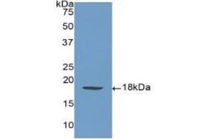 Western Blotting (WB) image for anti-Selectin P (Granule Membrane Protein 140kDa, Antigen CD62) (SELP) (AA 58-195) antibody (ABIN7432085)