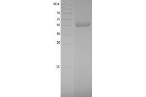 Western Blotting (WB) image for Mitogen-Activated Protein Kinase 11 (MAPK11) (AA 1-364) protein (His tag) (ABIN7123990)