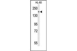 Western blot analysis of PLCB1 Antibody (C-term) in HL-60 cell line lysates (35ug/lane). (Phospholipase C beta 1 Antikörper  (C-Term))