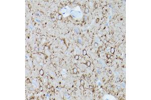 Immunohistochemistry of paraffin-embedded mouse brain using α-Tubulin Mouse mAb (ABIN7271035) at dilution of 1:100 (40x lens). (TUBA4A Antikörper)