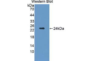 Western blot analysis of the recombinant protein. (CDNF Antikörper  (AA 20-183))