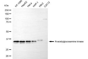 Western blotting analysis using N-acetylglucosamine kinase antibody (ABIN7799530). (NAGK Antikörper)