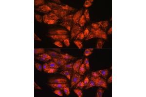 Immunofluorescence analysis of H9C2 cells using PPP1R15A Rabbit pAb (ABIN7269676) at dilution of 1:100. (GADD34 Antikörper  (AA 375-674))