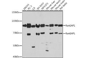 Western blot analysis of extracts of various cell lines, using RanG Rabbit mAb (ABIN7269846) at 1:1000 dilution.
