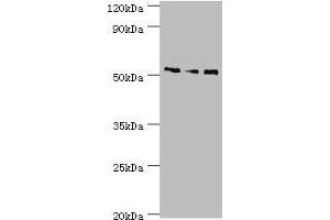 Western blot All lanes: Neuronal acetylcholine receptor subunit alpha-5 antibody at 12 μg/mL Lane 1: Jurkat whole cell lysate Lane 2: A431 whole cell lysate Lane 3: A549 whole cell lysate Secondary Goat polyclonal to rabbit IgG at 1/10000 dilution Predicted band size: 53 kDa Observed band size: 53 kDa (CHRNA5 Antikörper  (AA 23-240))
