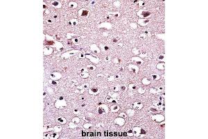 Immunohistochemistry (IHC) image for anti-Parkinson Protein 2, E3 Ubiquitin Protein Ligase (Parkin) (PARK2) antibody (ABIN3002635) (Parkin Antikörper)