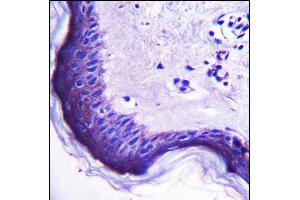 anti-Endogenous Retrovirus Group 3, Member 1 (ERV3-1) (AA 445-474), (C-Term) antibody