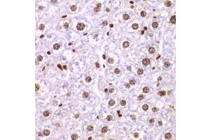 Immunohistochemistry of paraffin-embedded mouse liver using SSRP1 antibody at dilution of 1:200 (400x lens). (SSRP1 Antikörper)