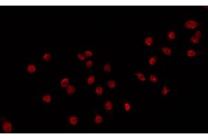 ABIN6266717 staining 293 by IF/ICC. (DLX3 Antikörper  (Internal Region))