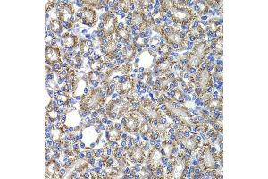 Immunohistochemistry of paraffin-embedded rat kidney using COPS2 antibody (ABIN6130123, ABIN6138877, ABIN6138878 and ABIN6222819) at dilution of 1:100 (40x lens). (COPS2 Antikörper  (AA 1-310))
