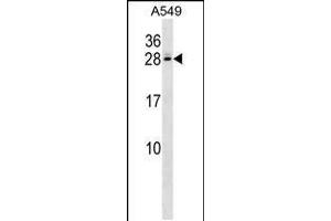 Western blot analysis in A549 cell line lysates (35ug/lane). (C4BPB Antikörper  (AA 125-153))