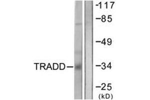 Western blot analysis of extracts from COS7 cells, using TRADD Antibody. (TRADD Antikörper  (AA 251-300))