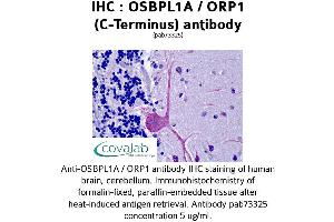 Image no. 1 for anti-Oxysterol Binding Protein-Like 1A (OSBPL1A) (C-Term) antibody (ABIN1737699)