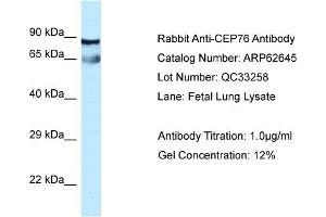 Western Blotting (WB) image for anti-Centrosomal Protein 76kDa (Cep76) (Middle Region) antibody (ABIN2789198) (Cep76 Antikörper  (Middle Region))