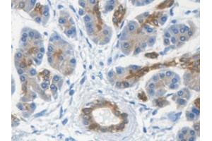 DAB staining on IHC-P; Samples: Human Kidney Tissue (Keratin 33A Antikörper  (AA 57-363))