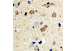 Immunohistochemical analysis of mPR gamma staining in human brain formalin fixed paraffin embedded tissue section. (PAQR5 Antikörper  (C-Term))