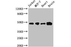 Western Blot Positive WB detected in: Jurkat whole cell lysate, MCF-7 whole cell lysate, Mouse heart tissue, Mouse brain tissue All lanes: ZNF645 antibody at 3. (ZNF645 Antikörper  (AA 200-413))