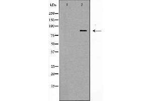 Western blot analysis of MCF7 cell lysate, using STAT1 Antibody. (STAT1 Antikörper  (C-Term))
