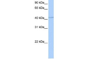WB Suggested Anti-DPH1 Antibody Titration: 0. (DPH1 Antikörper  (Middle Region))