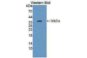 Western blot analysis of recombinant Human CDK18.
