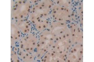 IHC-P analysis of Human Tissue, with DAB staining. (X-Ray Repair Cross Complementing 5 (AA 2-460) Antikörper)