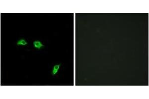 Immunofluorescence analysis of HeLa cells, using GABBR1 Antibody. (GABBR1 Antikörper  (AA 891-940))