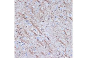 Immunohistochemistry of paraffin-embedded mouse brain using TMOD2 Rabbit mAb (ABIN7271011) at dilution of 1:100 (40x lens). (TMOD2 Antikörper)