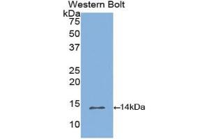 Western blot analysis of the recombinant protein. (INHBB Antikörper  (AA 277-391))