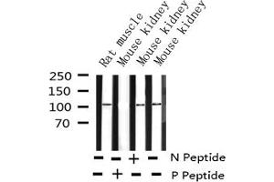 Western blot analysis of Phospho-PKD1/2/3/PKC μ (Ser738+Ser742) expression in various lysates (PKD1/2/3/PKC mu (pSer738), (pSer742) Antikörper)