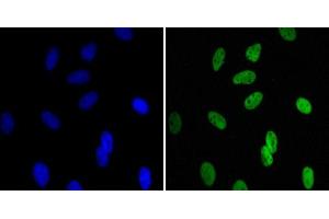 Immunofluorescence analysis of Hela cells using CBX1 mouse mAb (green). (CBX1 Antikörper)