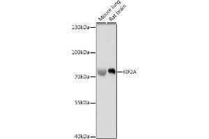 Western blot analysis of extracts of various cell lines, using KIF2A antibody (ABIN7268138) at 1:1000 dilution. (KIF2A Antikörper  (AA 30-220))