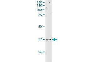 CD200R1 MaxPab rabbit polyclonal antibody. (CD200R1 Antikörper  (AA 1-348))