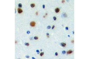 Immunohistochemical analysis of PWWP2B staining in human brain formalin fixed paraffin embedded tissue section. (PWWP2B Antikörper)