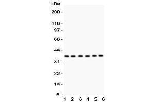 Western blot testing of Rad51 antibody and Lane 1:  22RV1 (RAD51 Antikörper  (AA 1-258))