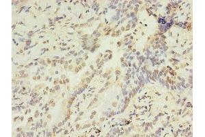 Immunohistochemistry (IHC) image for anti-Histone Cluster 1, H2ag (HIST1H2AG) (AA 2-130) antibody (ABIN7155356)