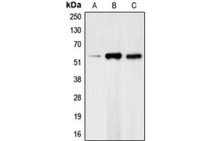 Western blot analysis of CHK1 (pS317) expression in HeLa (A), mouse kidney (B), rat heart (C) whole cell lysates. (CHEK1 Antikörper  (pSer317))