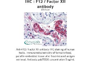 Image no. 2 for anti-Coagulation Factor XII (F12) antibody (ABIN1734212) (F12 Antikörper)