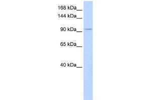 WB Suggested Anti-SALL3 Antibody Titration:  0. (SALL3 Antikörper  (Middle Region))